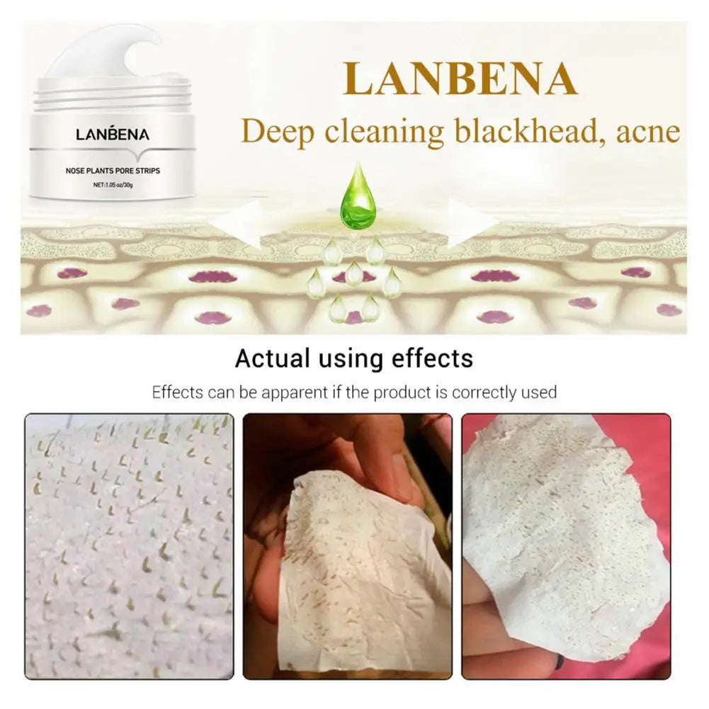 LANBENA Blackhead Remover Nose Mask Cream Acne Gentle Nose Plants Pores Strips Peeling Acne Treatment Healthy Skin Care Korea