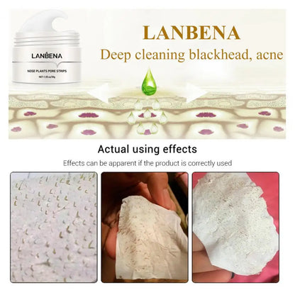 LANBENA Blackhead Remover Nose Mask Cream Acne Gentle Nose Plants Pores Strips Peeling Acne Treatment Healthy Skin Care Korea